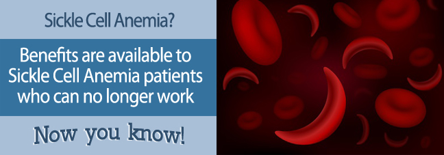 Can I work with Sickle Cell Disease?